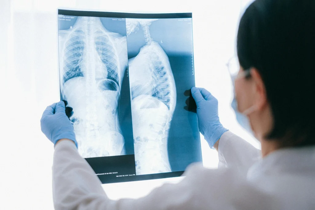 a doctor examining a spinal cord x-ray